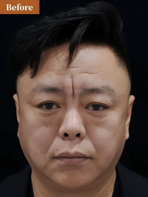 健保24小时在线套医保微信能用吗怎么弄？官方解答来了